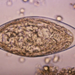 Una infección a menudo ignorada podría aumentar el riesgo de cáncer