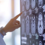 Privación de sueño afecta distintas zonas del cerebro, según una investigación