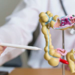 Estos sencillos cambios en la dieta reducen el riesgo de cáncer de colon