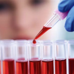 Día Mundial del Cáncer de Sangre: nuevo avance en el tratamiento de la leucemia mieloide crónica